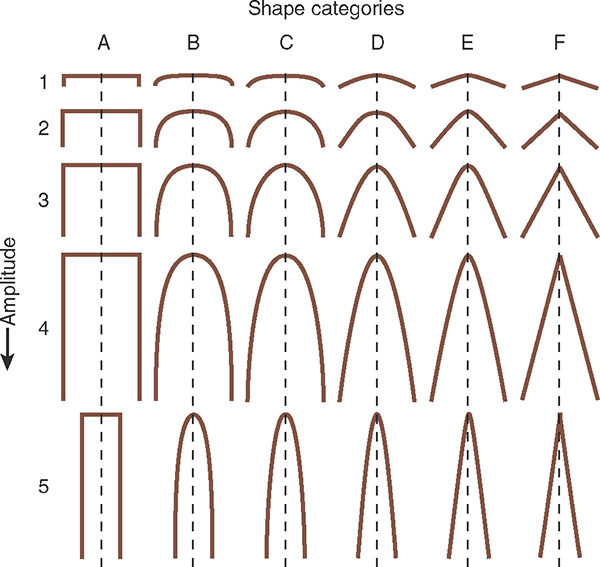 Shape and Amplitude Classification